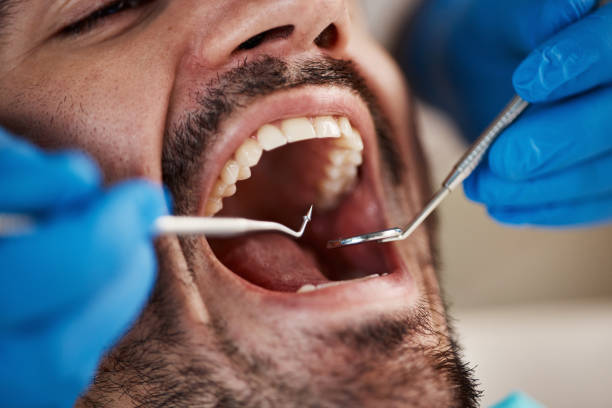 Best Emergency Cosmetic Dentistry in Drum Point, MD